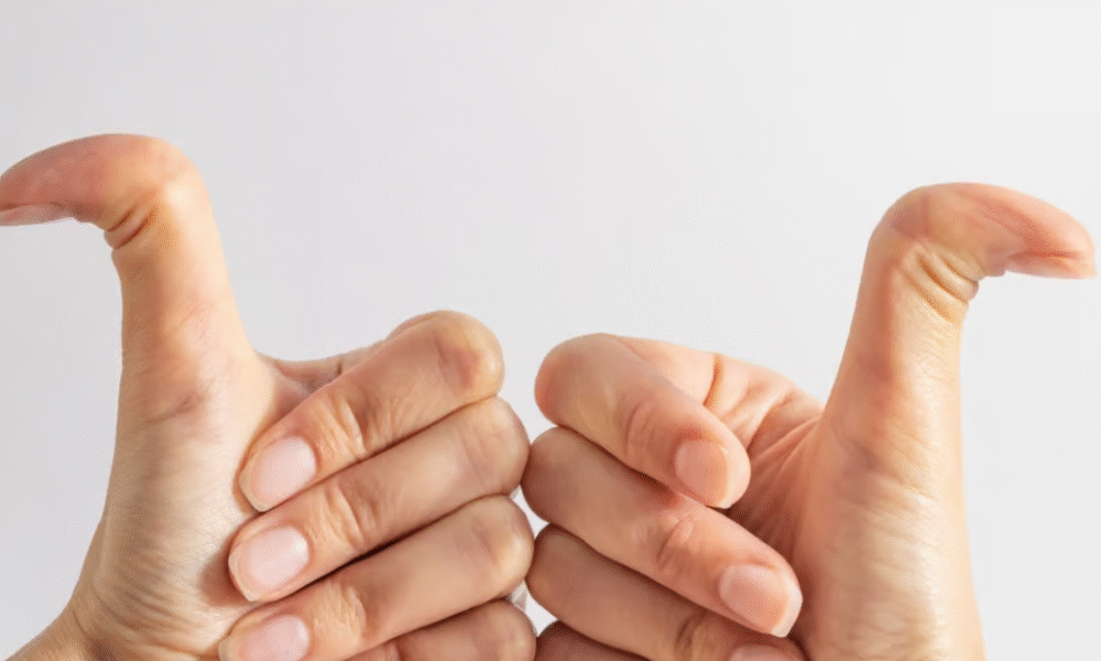 23 signs you grew up with ehlers-danlos syndrome